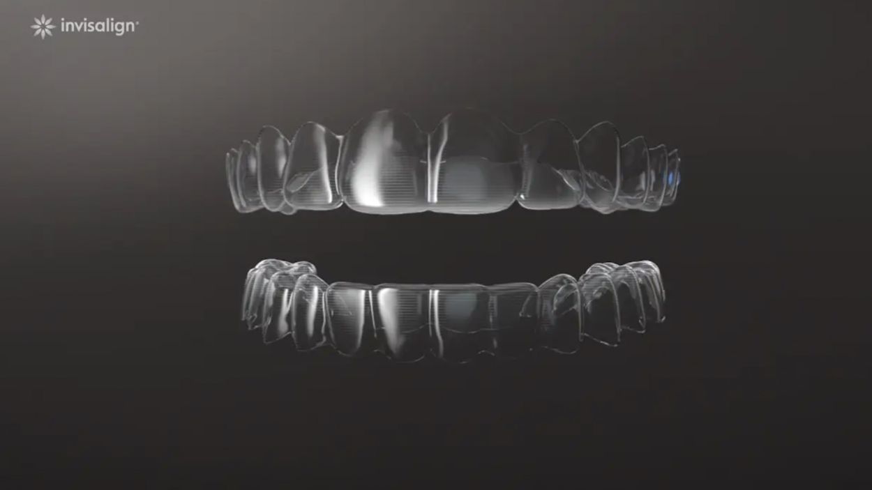 Patient wearing Invisalign clear aligners