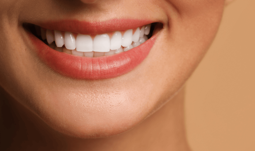 Healthy gums after periodontology treatment