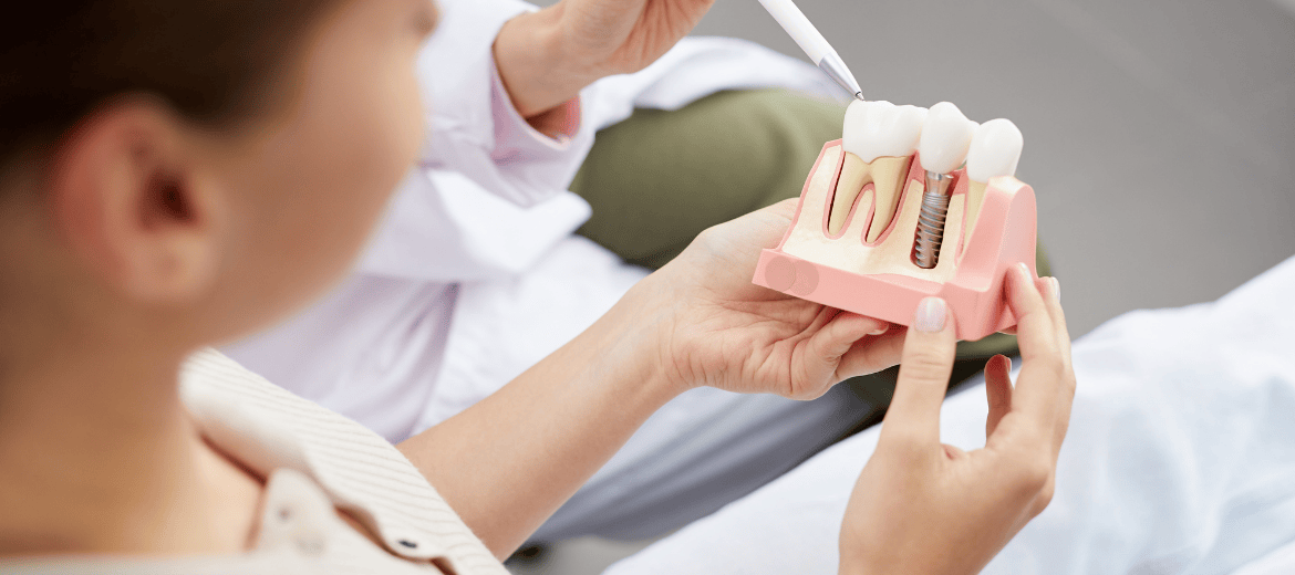 Dental Implants